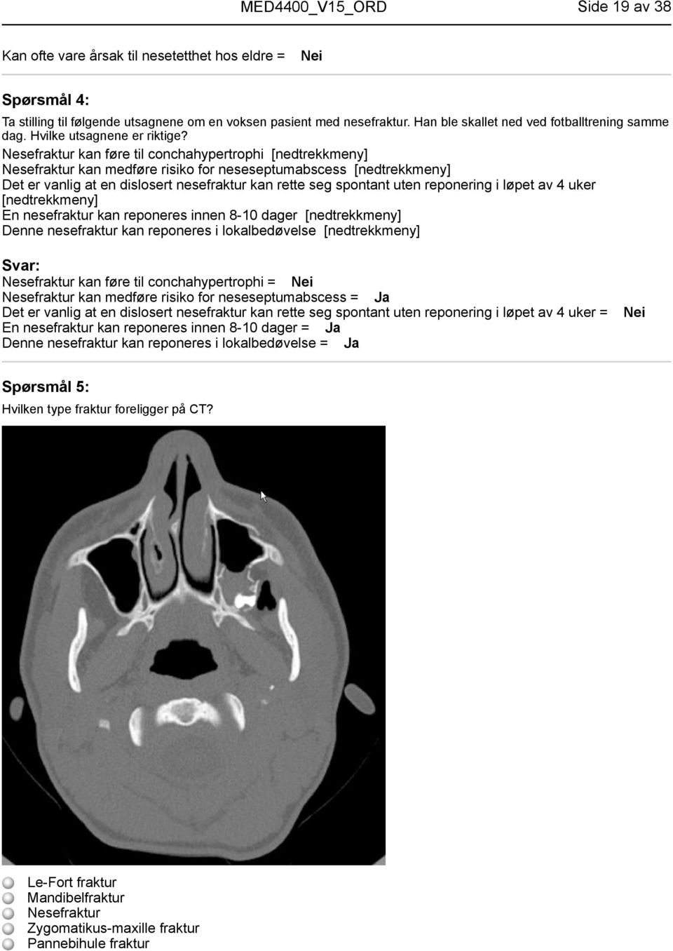 Nesefraktur kan føre til conchahypertrophi [nedtrekkmeny] Nesefraktur kan medføre risiko for neseseptumabscess [nedtrekkmeny] Det er vanlig at en dislosert nesefraktur kan rette seg spontant uten