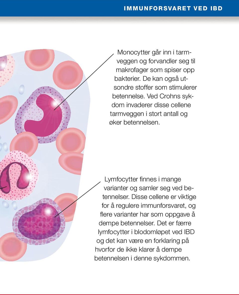 Lymfocytter finnes i mange varianter og samler seg ved betennelser.