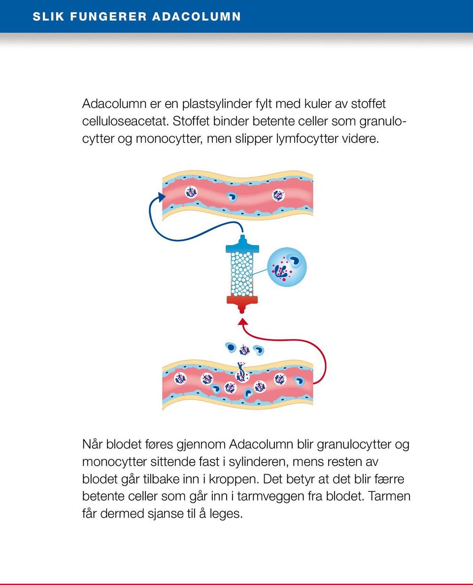 Når blodet føres gjennom Adacolumn blir granulocytter og monocytter sittende fast i sylinderen, mens resten av