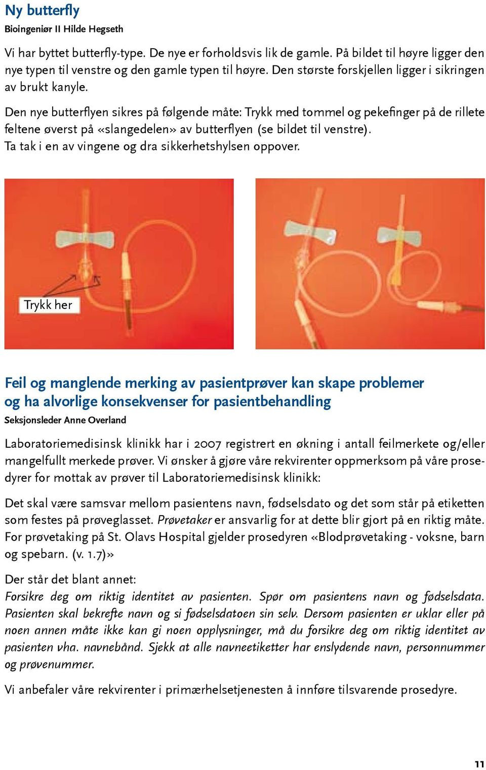 Den nye butterflyen sikres på følgende måte: Trykk med tommel og pekefinger på de rillete feltene øverst på «slangedelen» av butterflyen (se bildet til venstre).