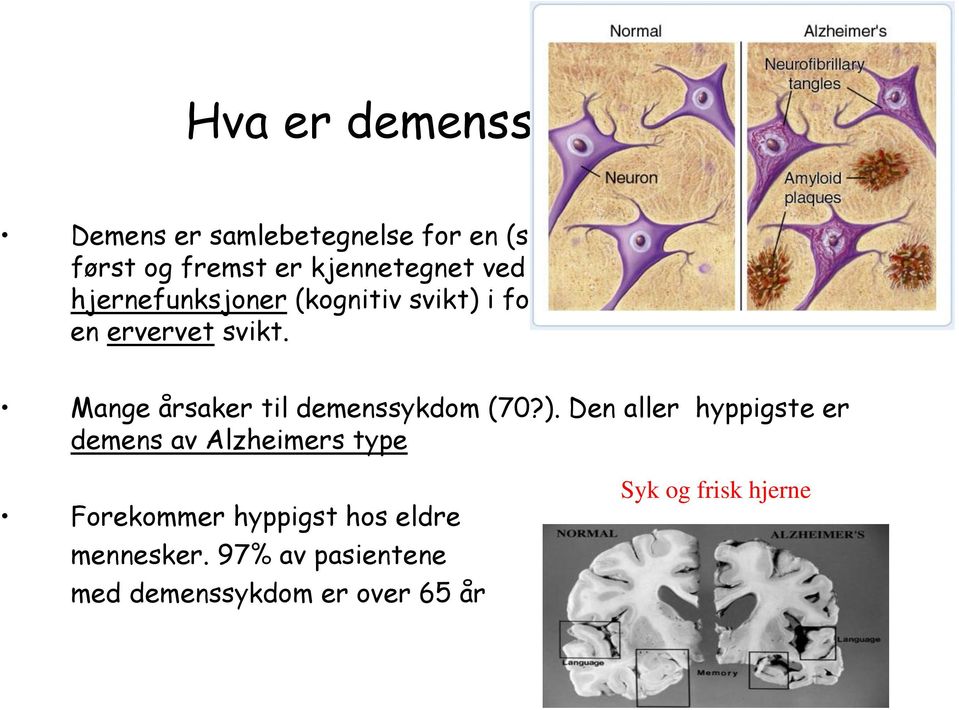 svekkelse av høyere hjernefunksjoner (kognitiv svikt) i forhold til tidligere nivå, altså en ervervet