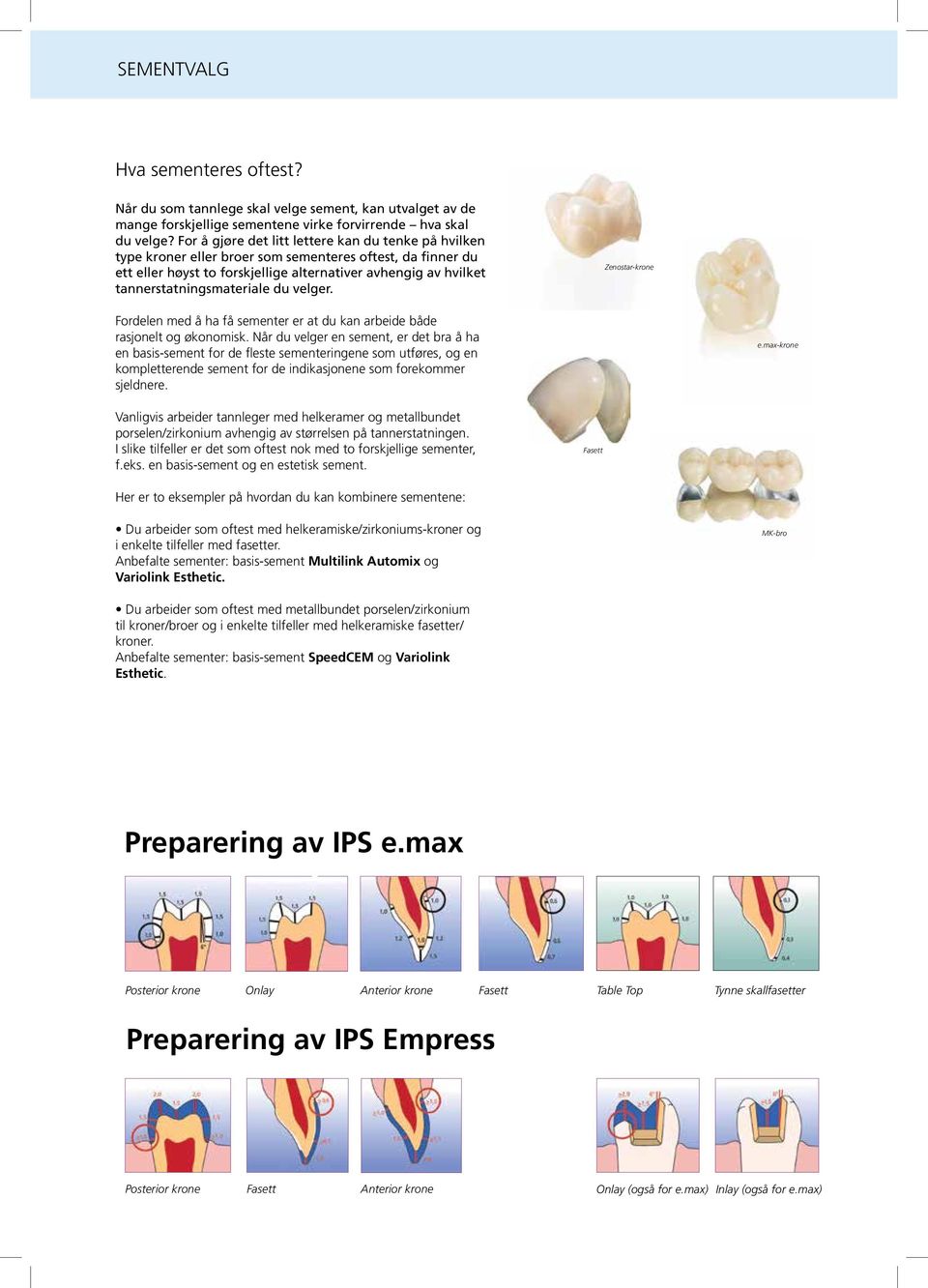 tannerstatningsmateriale du velger. Zenostar-krone Fordelen med å ha få sementer er at du kan arbeide både rasjonelt og økonomisk.
