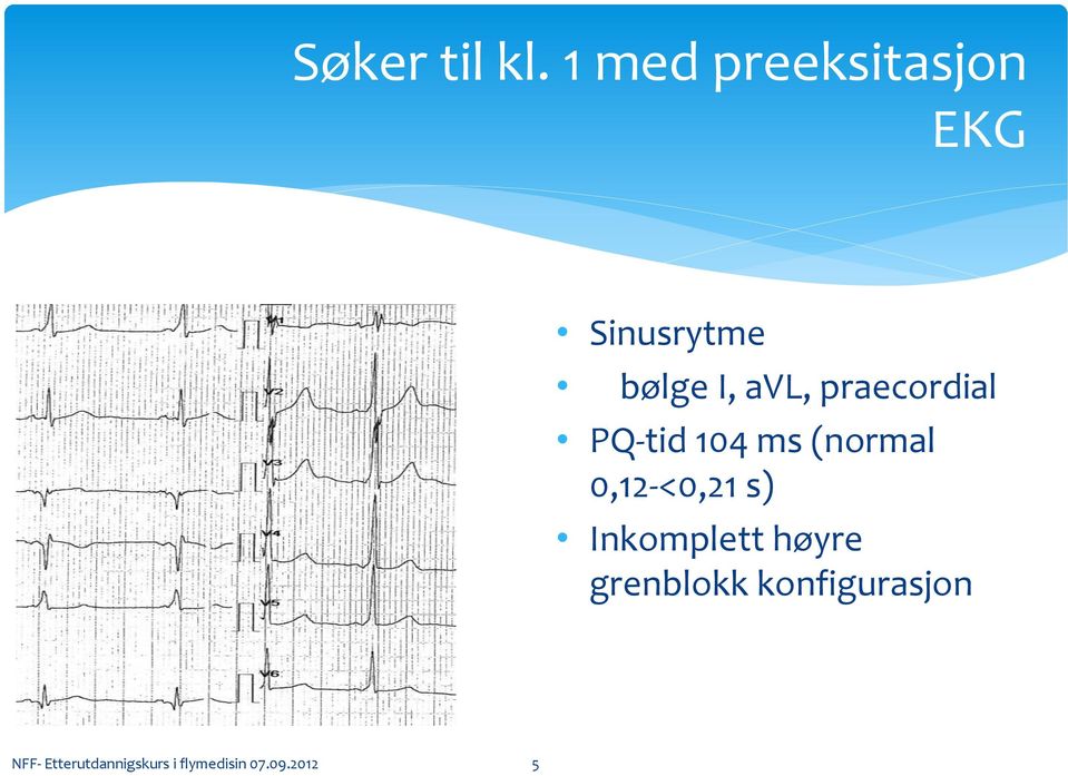 praecordial PQ-tid 104 ms (normal 0,12-<0,21 s)