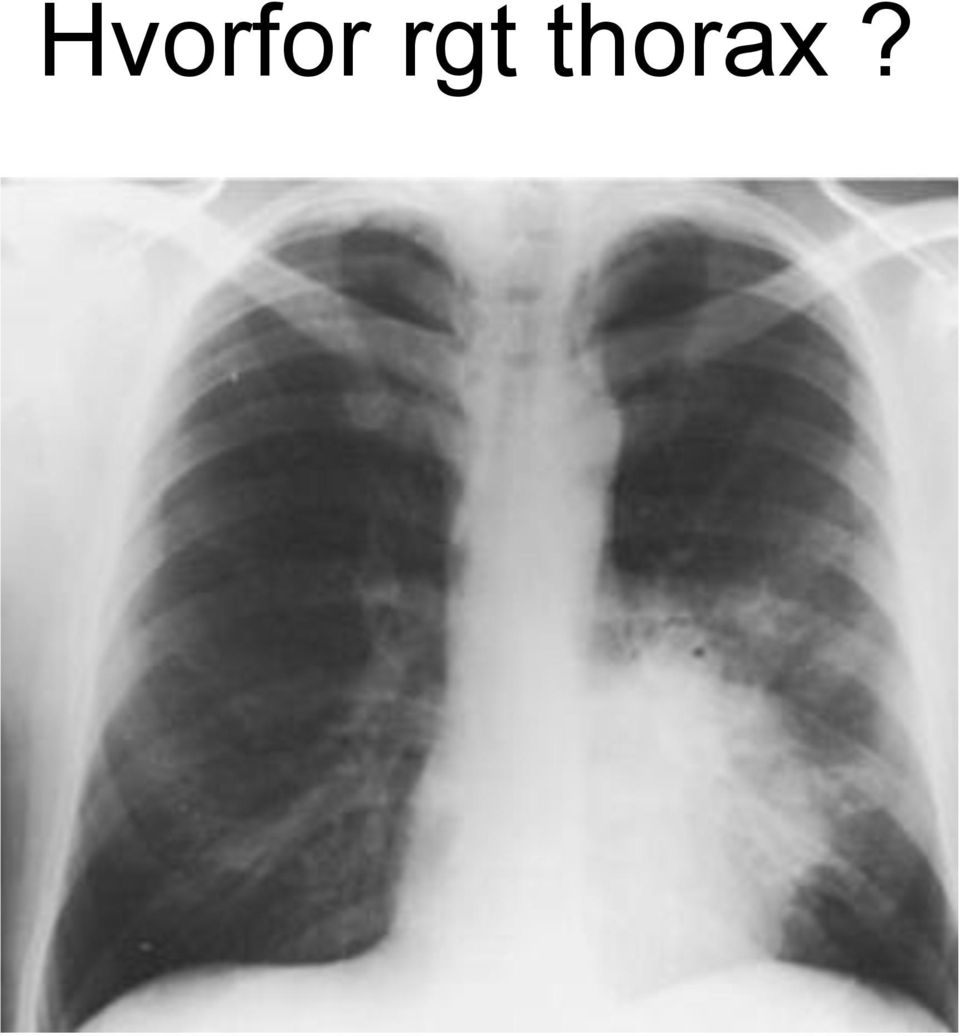 thorax?