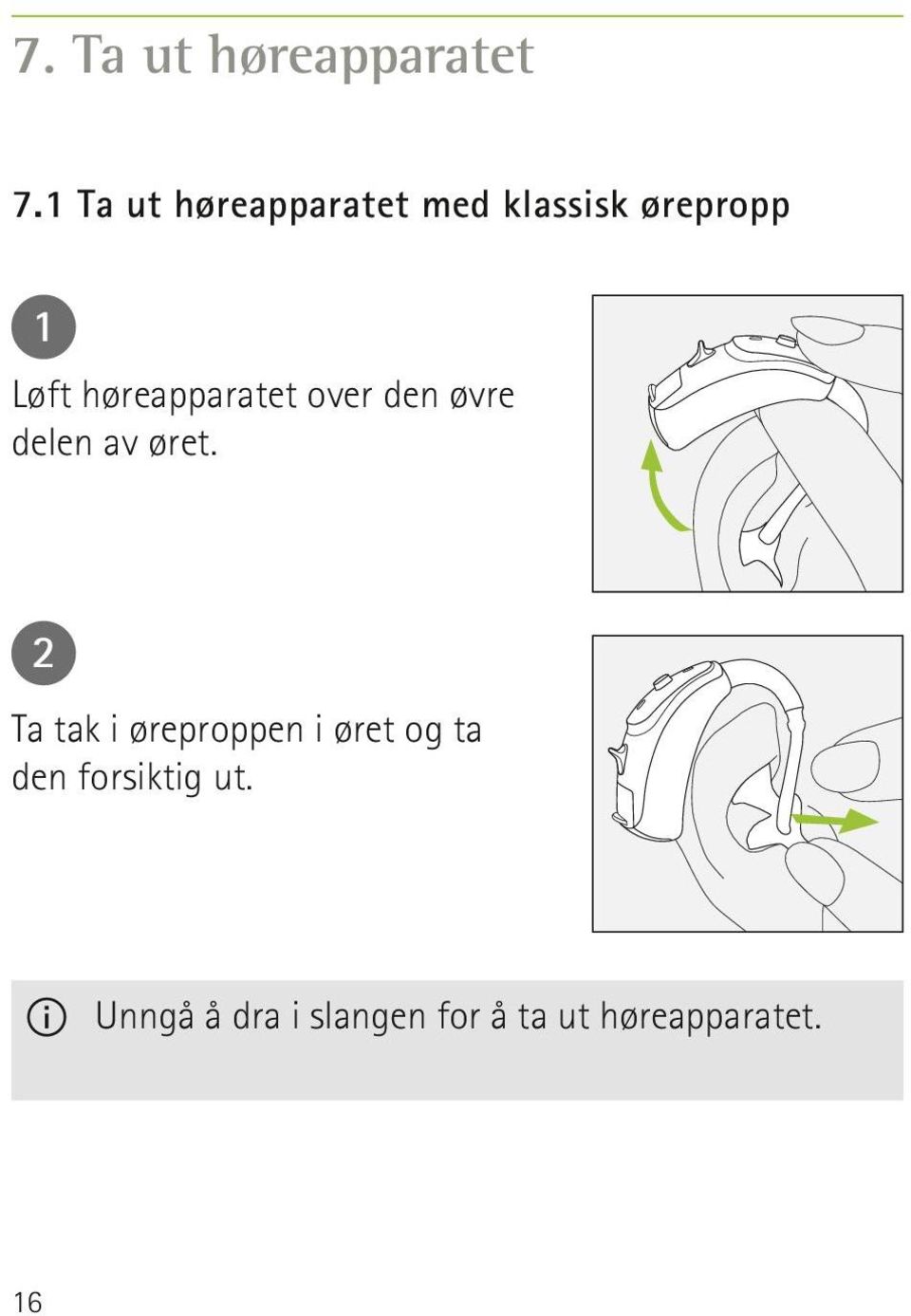 høreapparatet over den øvre delen av øret.