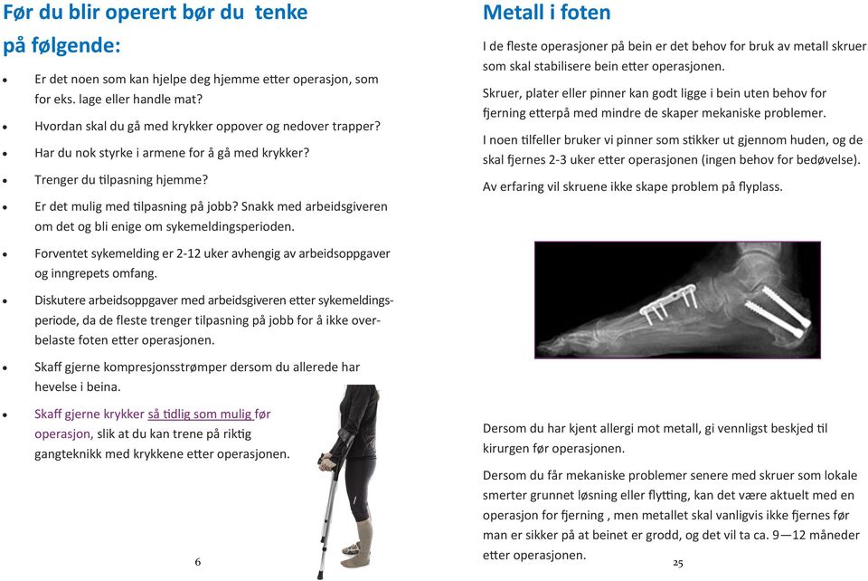 Metall i foten I de fleste operasjoner på bein er det behov for bruk av metall skruer som skal stabilisere bein etter operasjonen.