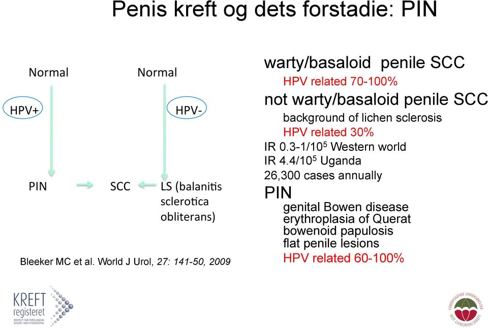 World J Urol, 27: 141-50, 2009 warty/basaloid penile SCC HPV related 70-100% not warty/basaloid penile SCC