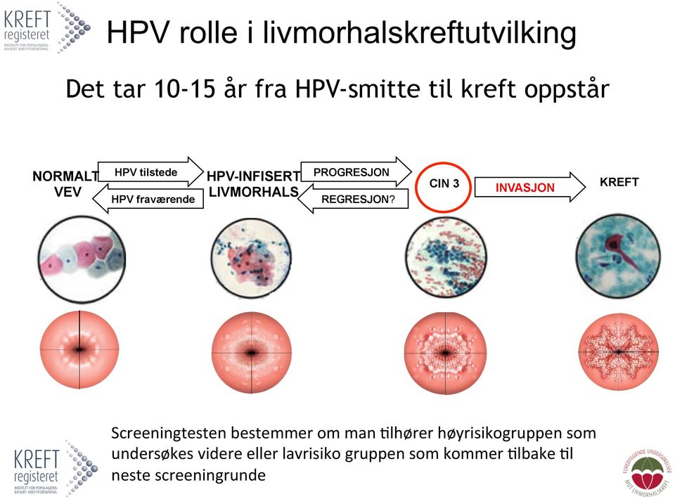 CIN 3 INVASJON KREFT Screeningtesten bestemmer om man 8lhører