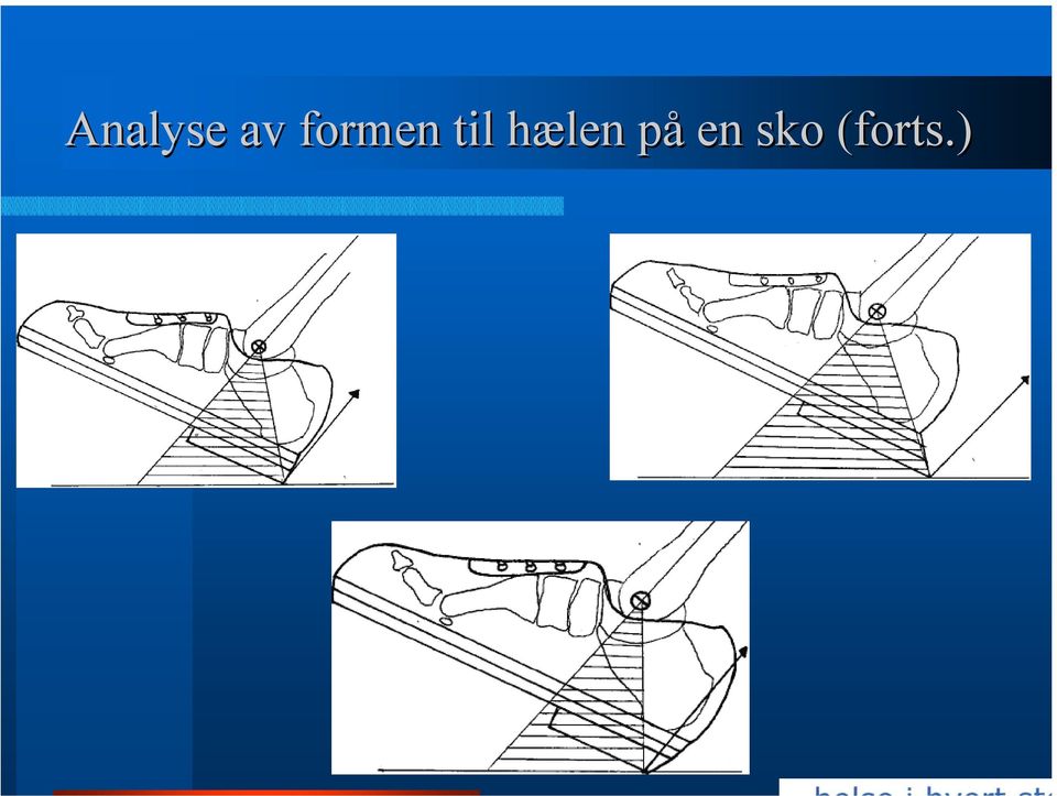 hælen på en