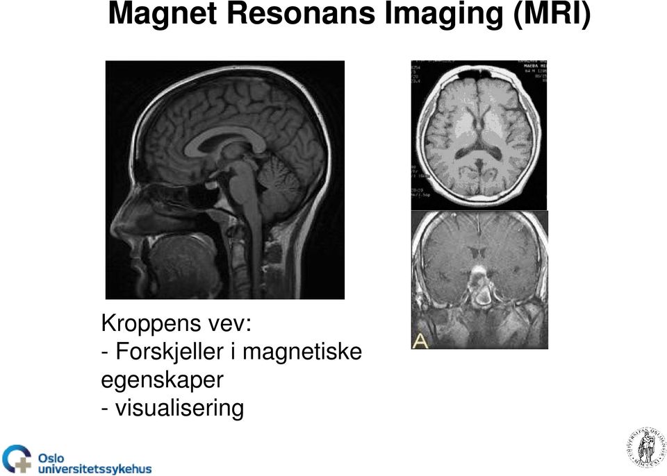 Forskjeller i magnetiske