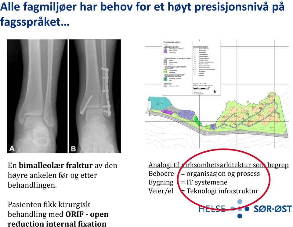 Pasienten fikk kirurgisk behandling med ORIF - open reduction internal fixation Analogi