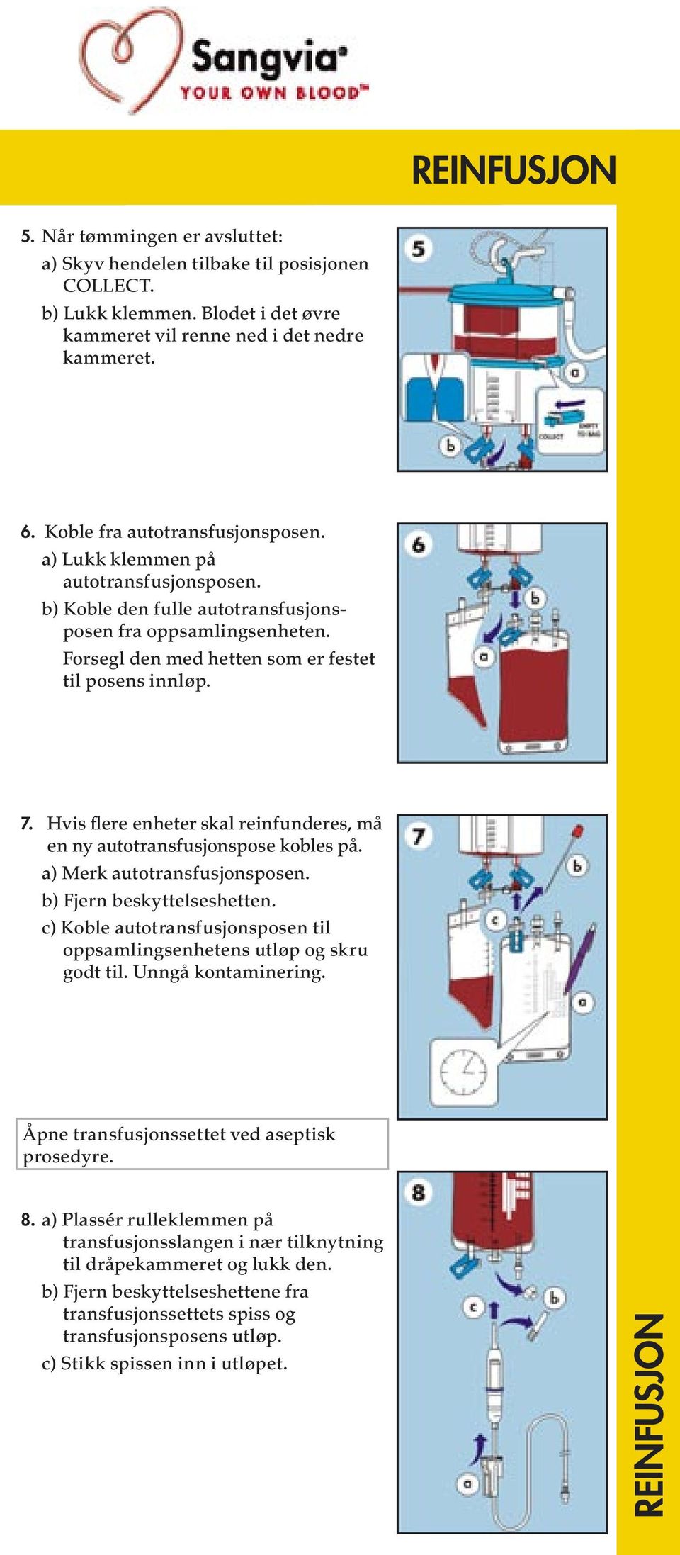 Hvis flere enheter skal reinfunderes, må en ny autotransfusjonspose kobles på. a) Merk autotransfusjonsposen. b) Fjern beskyttelseshetten.