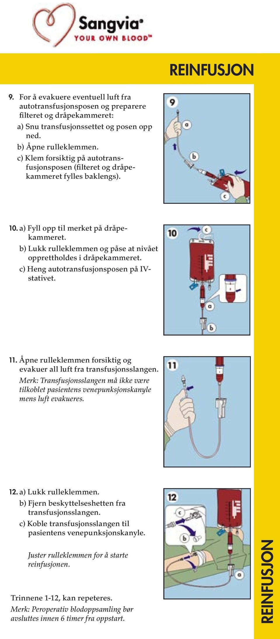 b) Lukk rulleklemmen og påse at nivået opprettholdes i dråpekammeret. c) Heng autotransfusjonsposen på IVstativet. 11. Åpne rulleklemmen forsiktig og evakuer all luft fra transfusjonsslangen.