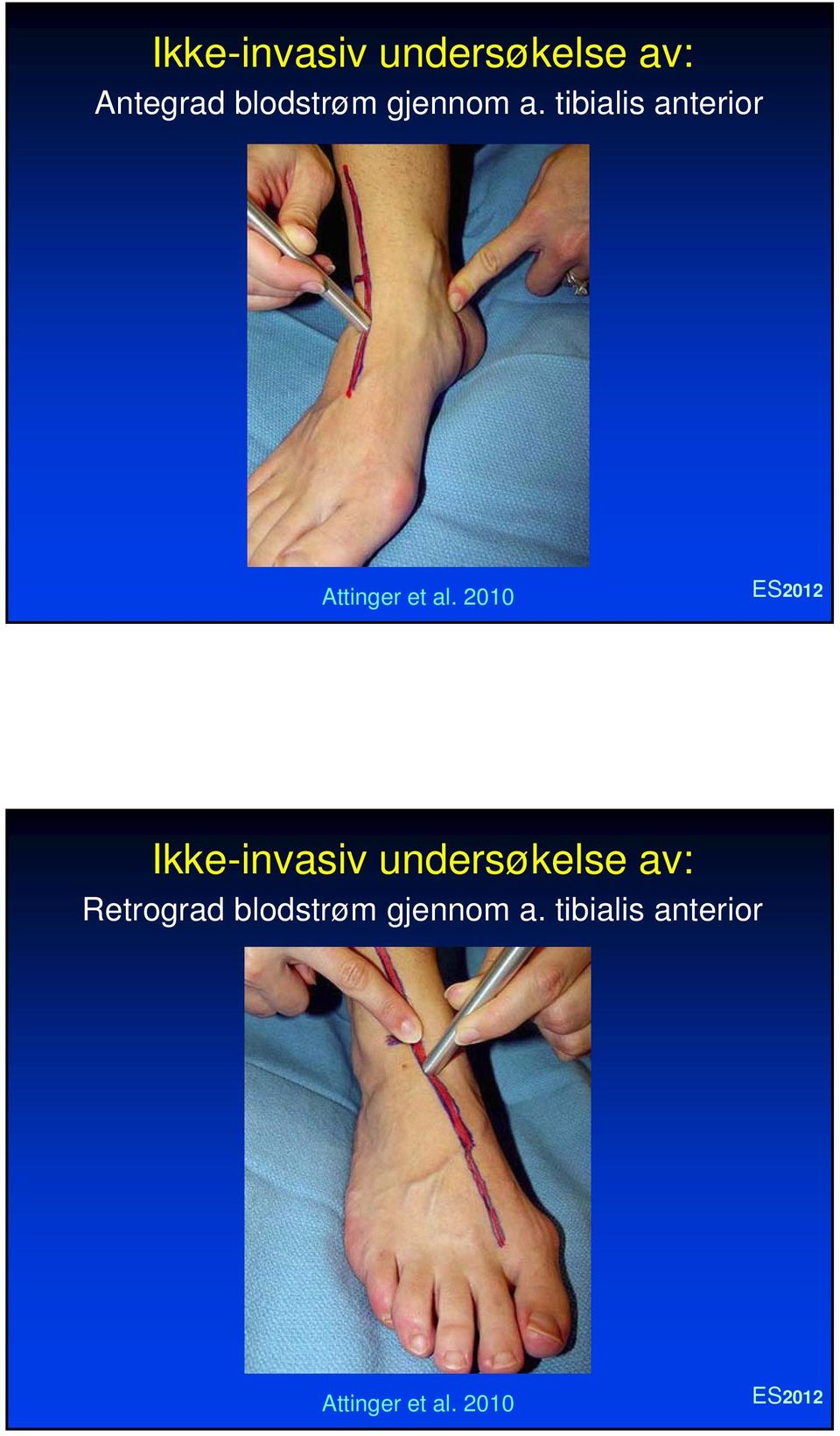 2010 Ikke-invasiv undersøkelse av: Retrograd