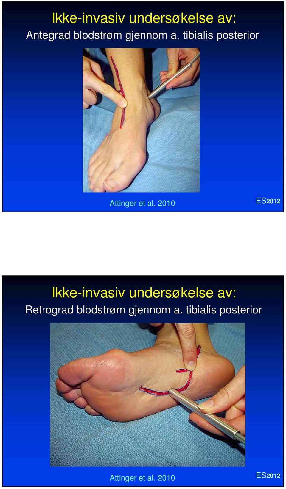 2010 Ikke-invasiv undersøkelse av: Retrograd