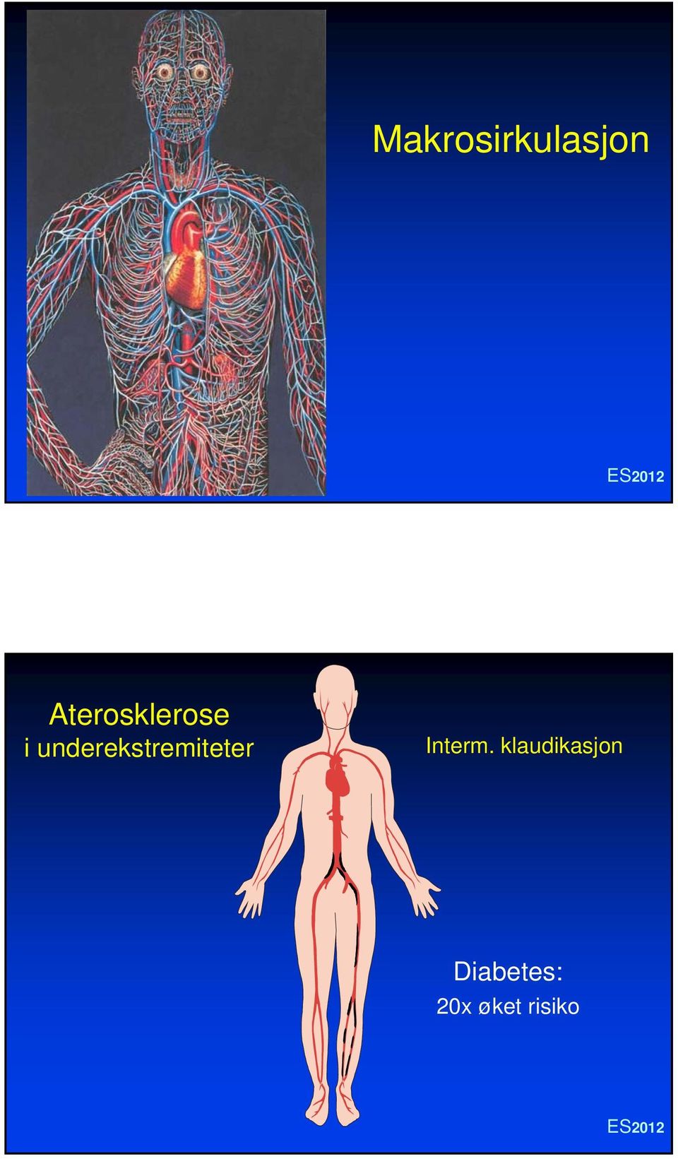 underekstremiteter Interm.