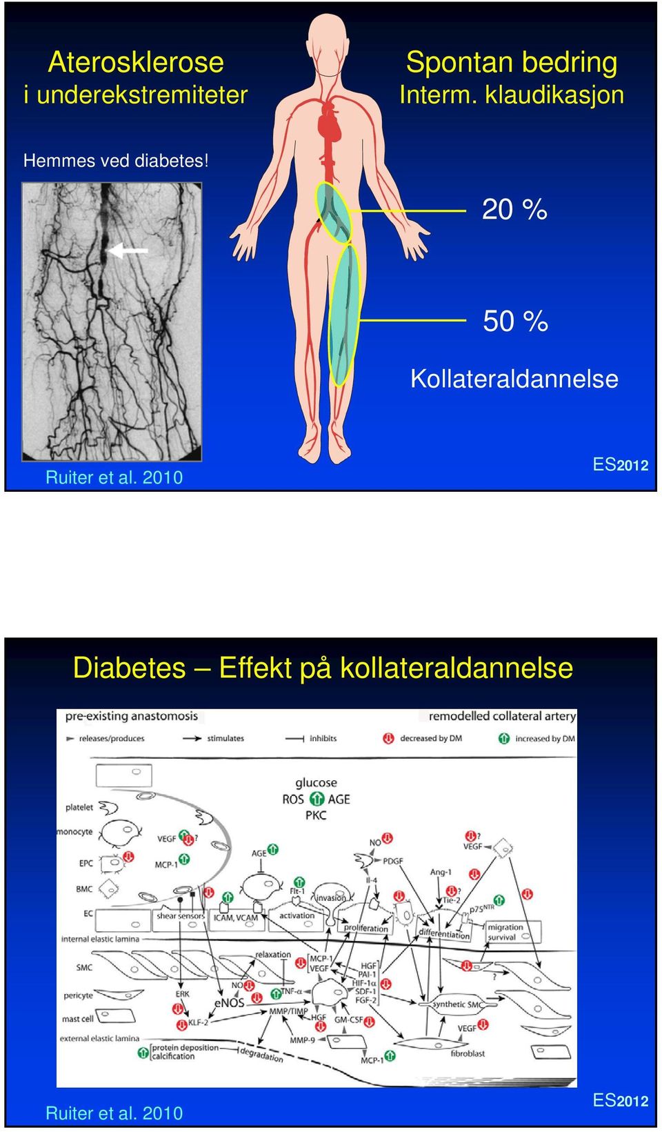 20 % 50 % Kollateraldannelse Ruiter et al.