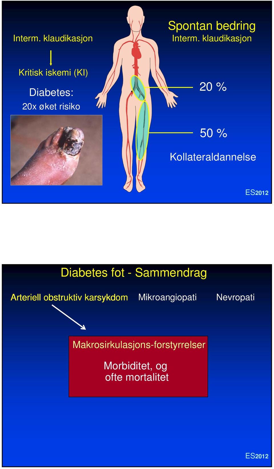 Kollateraldannelse Diabetes fot - Sammendrag Arteriell obstruktiv