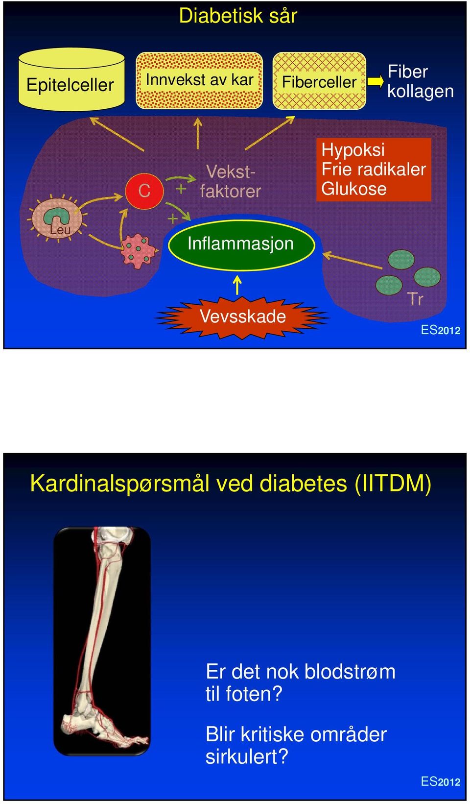 radikaler Glukose Vevsskade Tr Kardinalspørsmål ved diabetes