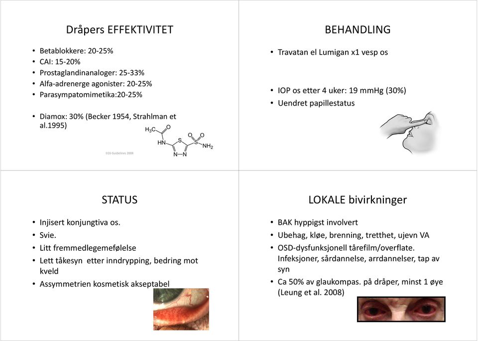 Litt fremmedlegemefølelse Lett tåkesyn etter inndrypping, bedring mot kveld Assymmetrien kosmetisk akseptabel LOKALE bivirkninger BAK hyppigst involvert Ubehag, kløe,