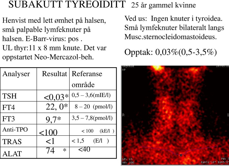 Analyser TSH FT4 FT3 Anti-TPO TRAS Resultat <0,03* 22, 0* 9,7* <100 <1 Referanse område 0,5 3,6(mIE/l) 8 20 (pmol/l) 3,5