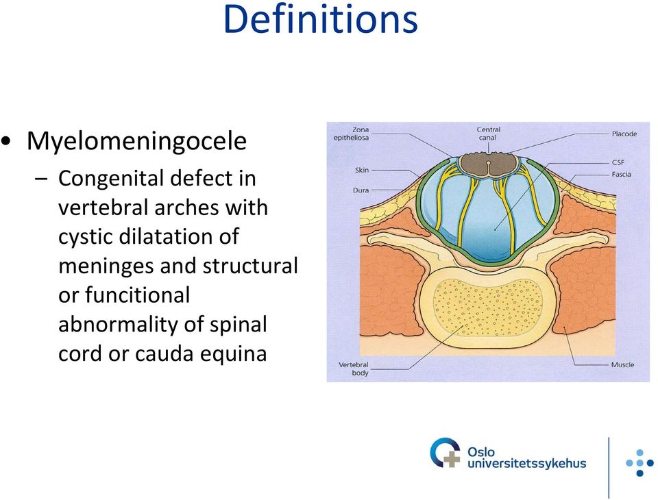 dilatation of meninges and structural or