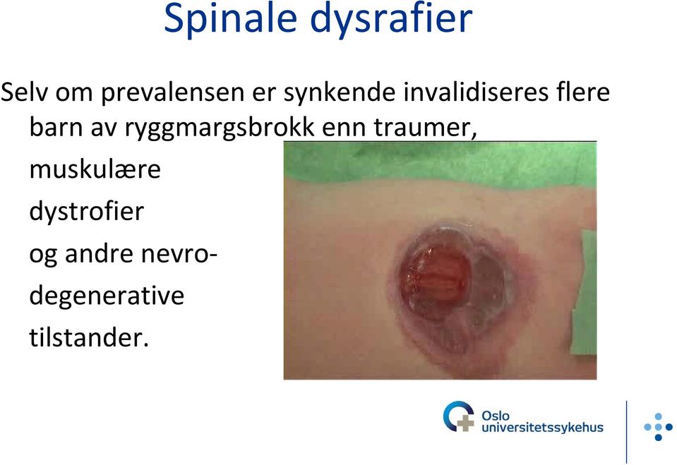 ryggmargsbrokk enn traumer, muskulære