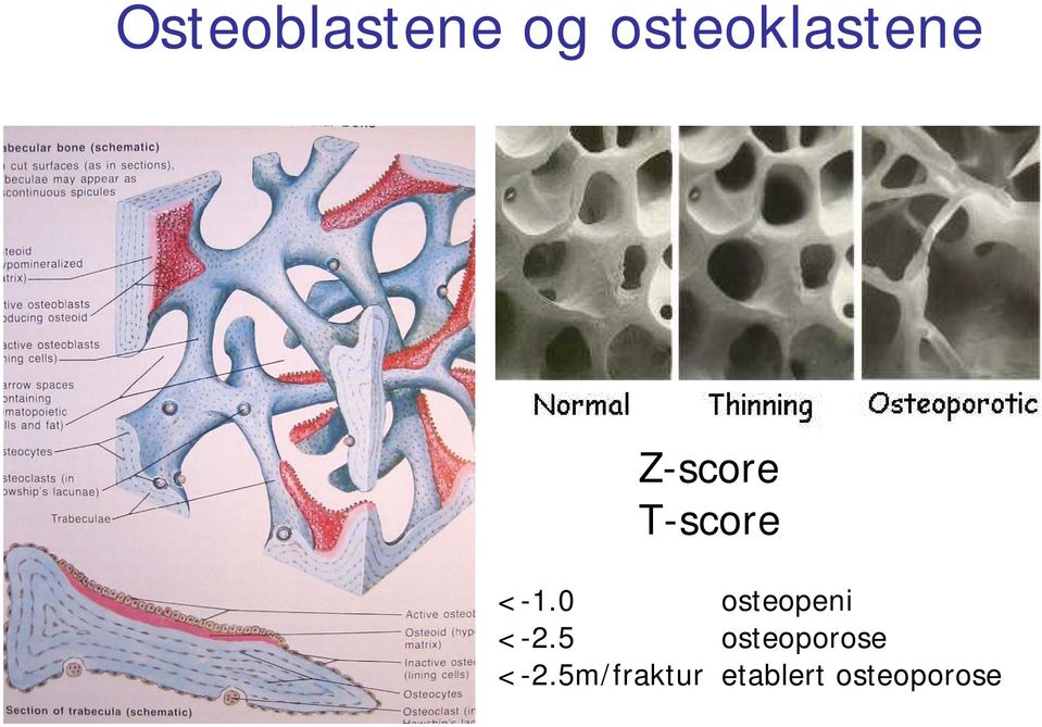 T-score <-1.0 osteopeni <-2.
