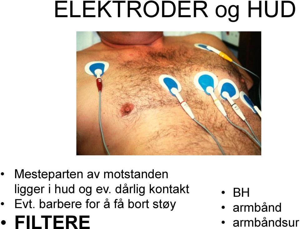 dårlig kontakt Evt.