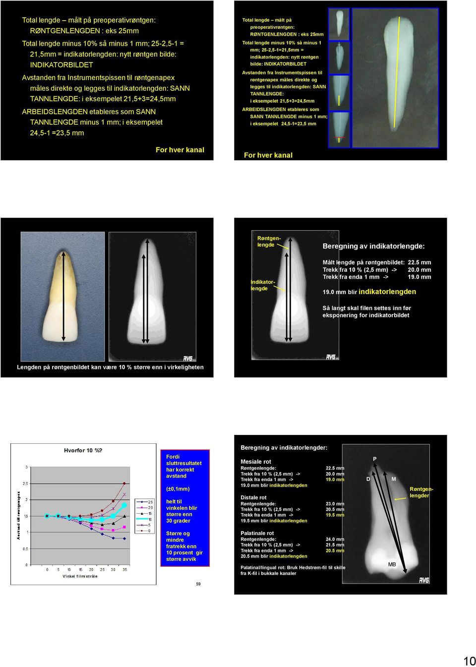 24,5-1 =23,5 mm Total lengde målt på preoperativrøntgen: RØNTGENLENGDEN : eks 25mm Total lengde minus 10% så minus 1 mm; 25-2,5-1=21,5mm = indikatorlengden: nytt røntgen : INDIKATORBILDET Avstanden