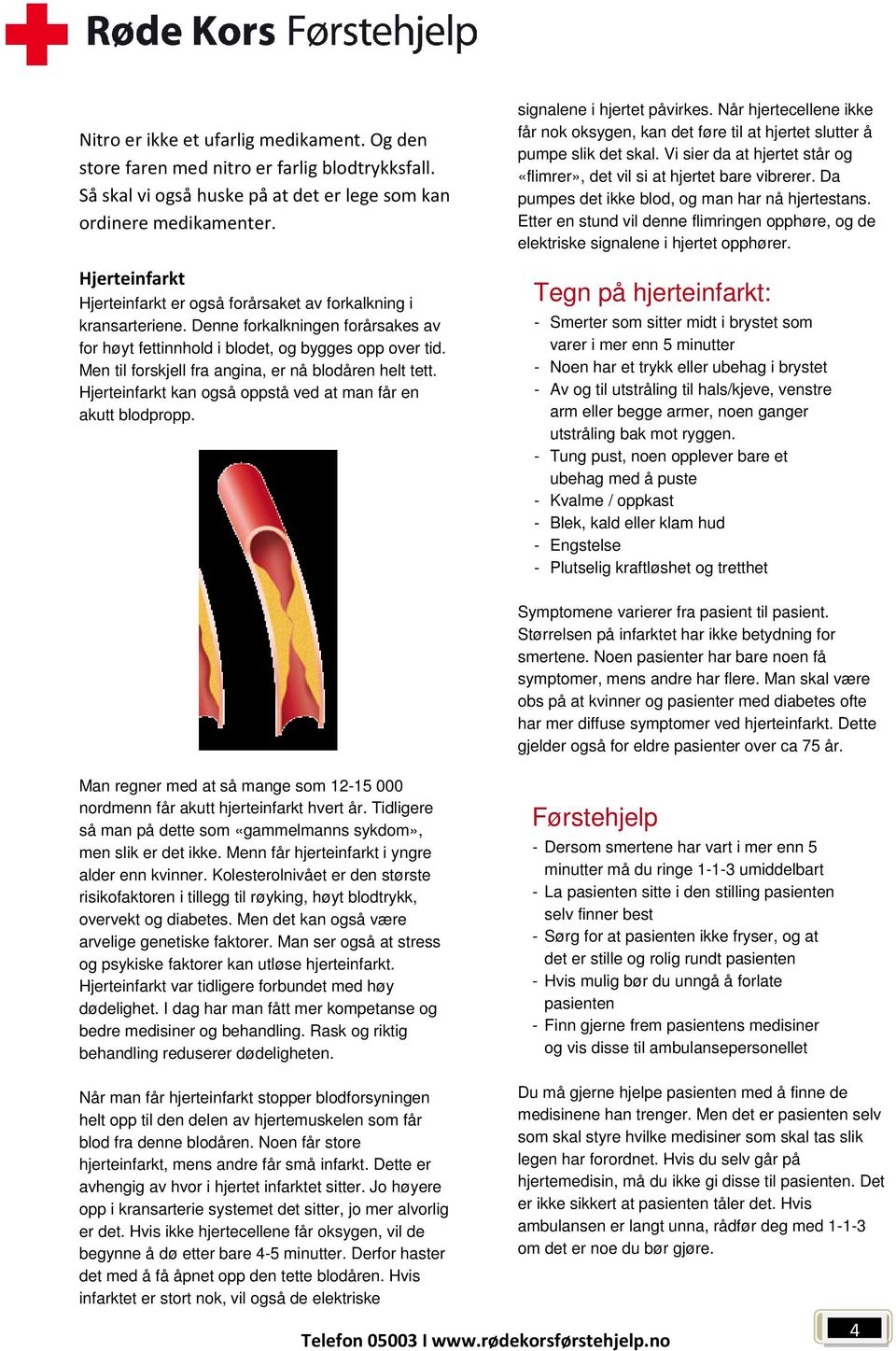 Men til forskjell fra angina, er nå blodåren helt tett. Hjerteinfarkt kan også oppstå ved at man får en akutt blodpropp. signalene i hjertet påvirkes.