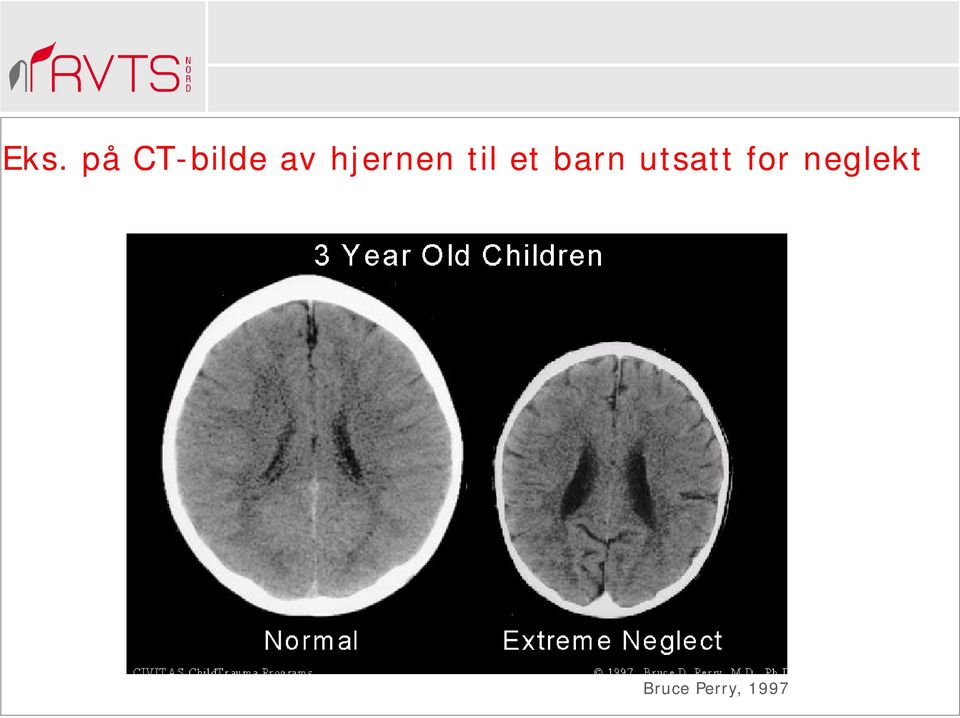 barn utsatt for