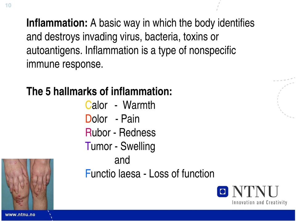 Inflammation is a type of nonspecific immune response.