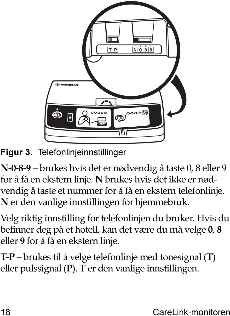 Velg riktig innstilling for telefonlinjen du bruker.