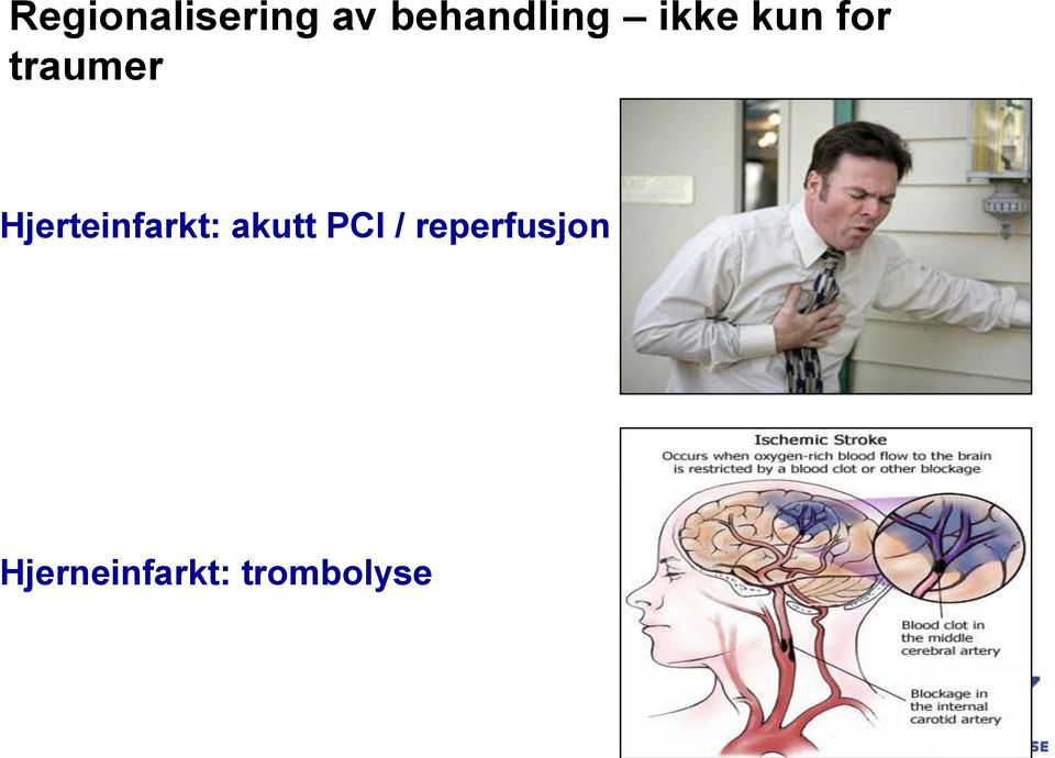 traumer Hjerteinfarkt: akutt