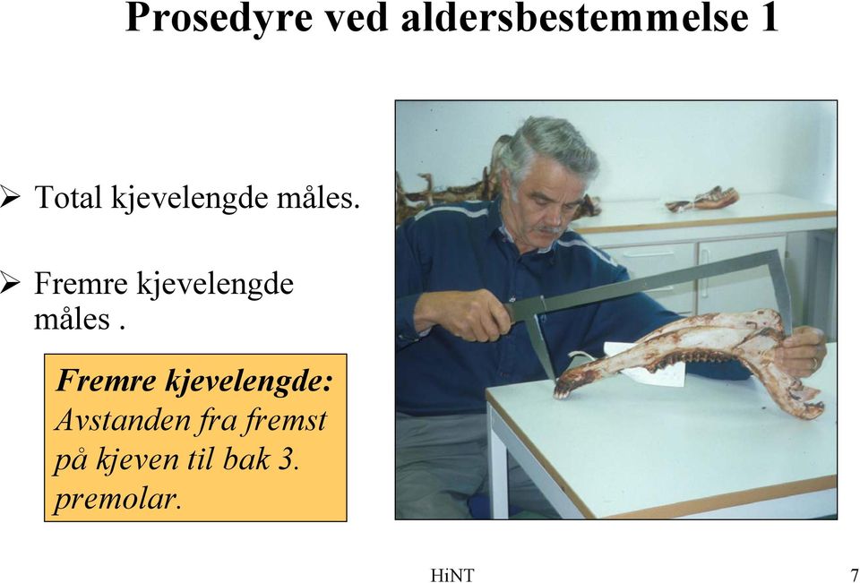 Fremre  Fremre kjevelengde: Avstanden