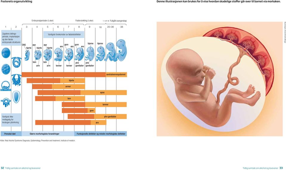 forekomster av fødselsdefekter øre gom øre Fosterutvikling (i uker) gom øre hjerne hjerne Fullgått svangerskap Illustrasjon: Anne Kristin Berge ben arm ben arm tenner tenner ytre genitalier ytre