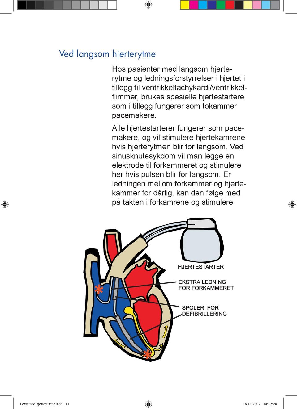 Alle hjertestarterer fungerer som pacemakere, og vil stimulere hjertekamrene hvis hjerterytmen blir for langsom.