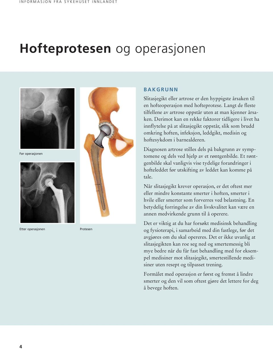 Derimot kan en rekke faktorer tidligere i livet ha innflytelse på at slitasjegikt oppstår, slik som brudd omkring hoften, infeksjon, leddgikt, medisin og hoftesykdom i barne alderen.