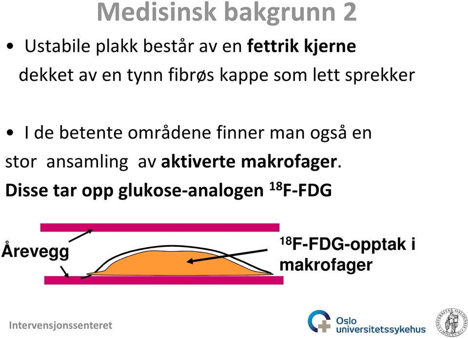 områdene finner man også en stor ansamling av aktiverte makrofager.