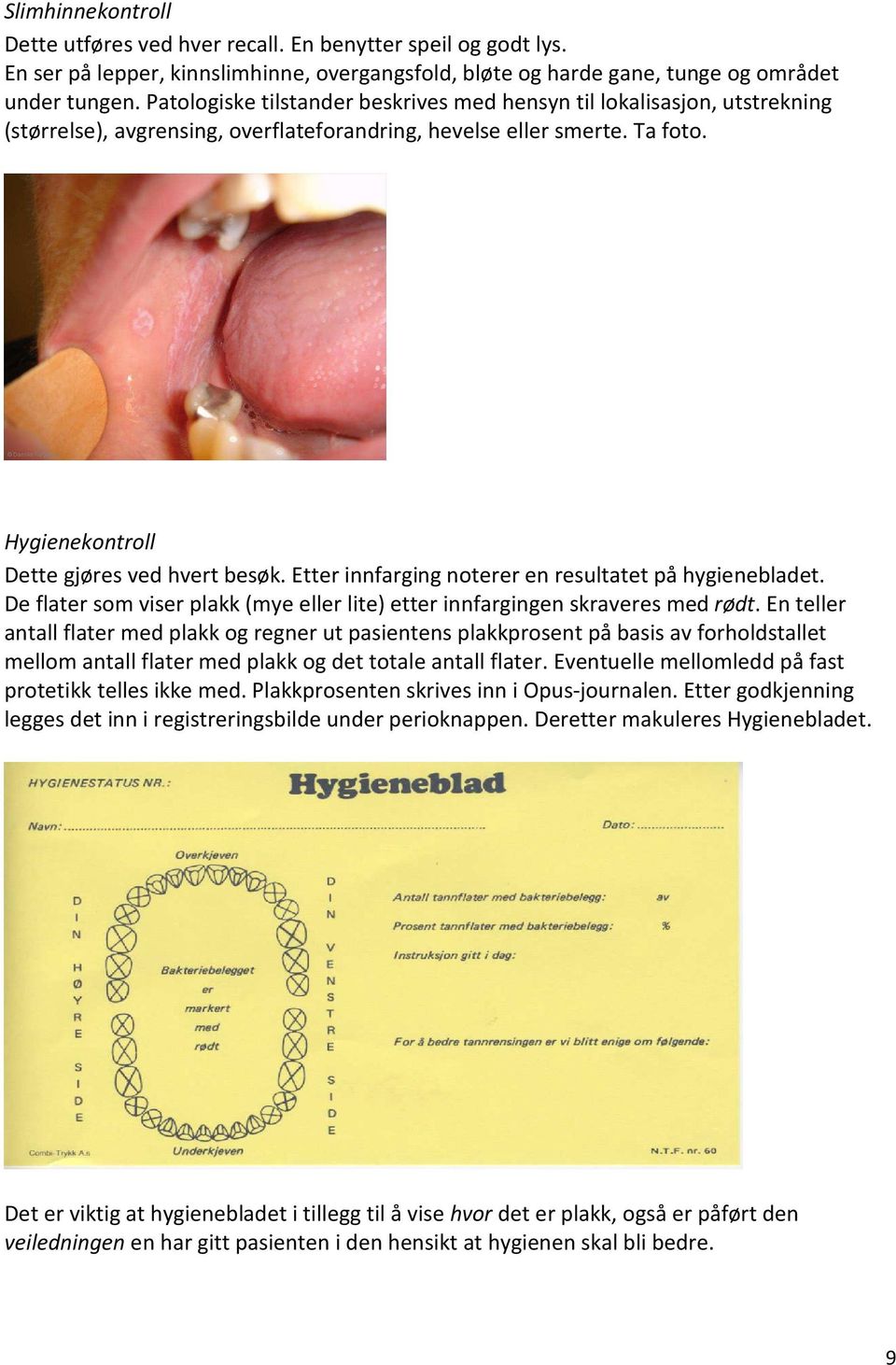 Etter innfarging noterer en resultatet på hygienebladet. De flater som viser plakk (mye eller lite) etter innfargingen skraveres med rødt.