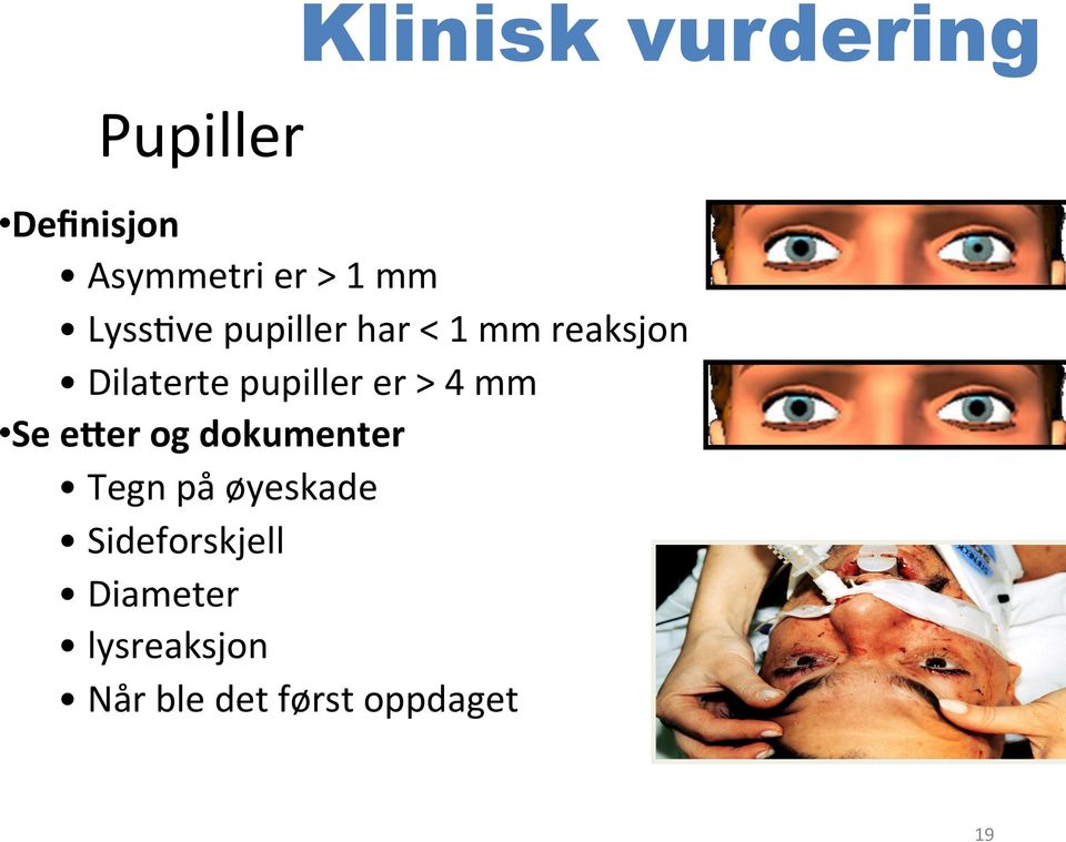 er > 4 mm Se e5er og dokumenter Tegn på øyeskade