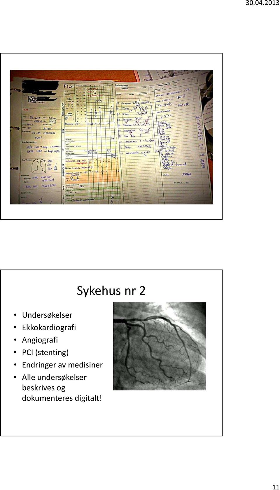 (stenting) Endringer av medisiner