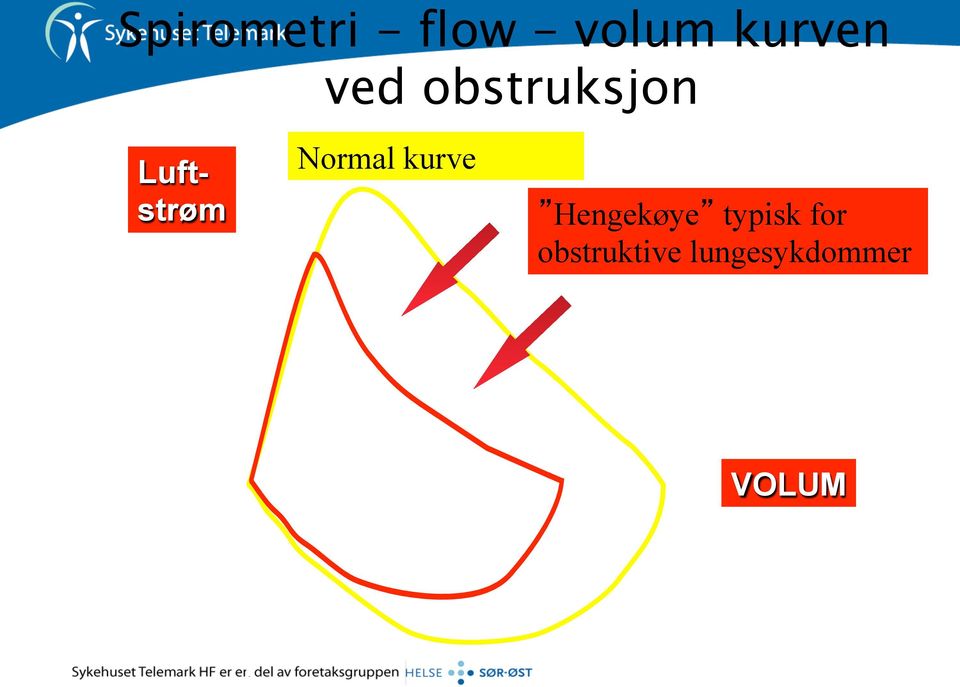 Luftstrøm Normal kurve