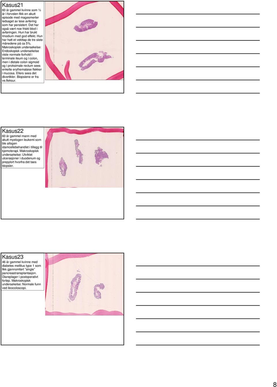 Makroskopisk undersøkelse: Endoskopisk undersøkelse viste normale forhold i terminale ileum og i colon, men i distale colon sigmoid og i proksimale rectum sees enkelte erythematøse flekker i mucosa.