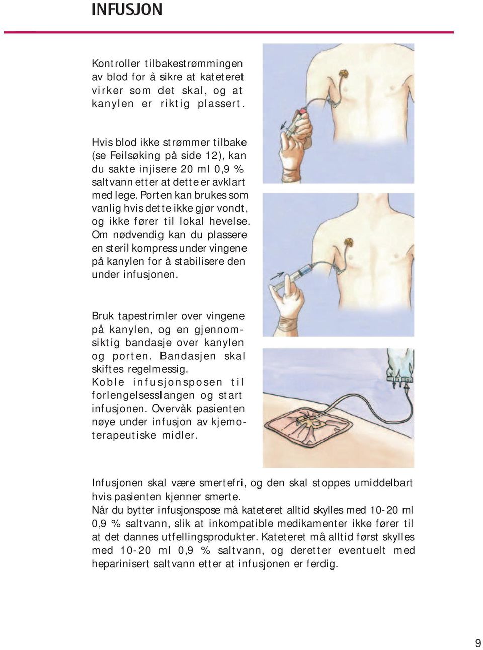 Porten kan brukes som vanlig hvis dette ikke gjør vondt, og ikke fører til lokal hevelse.