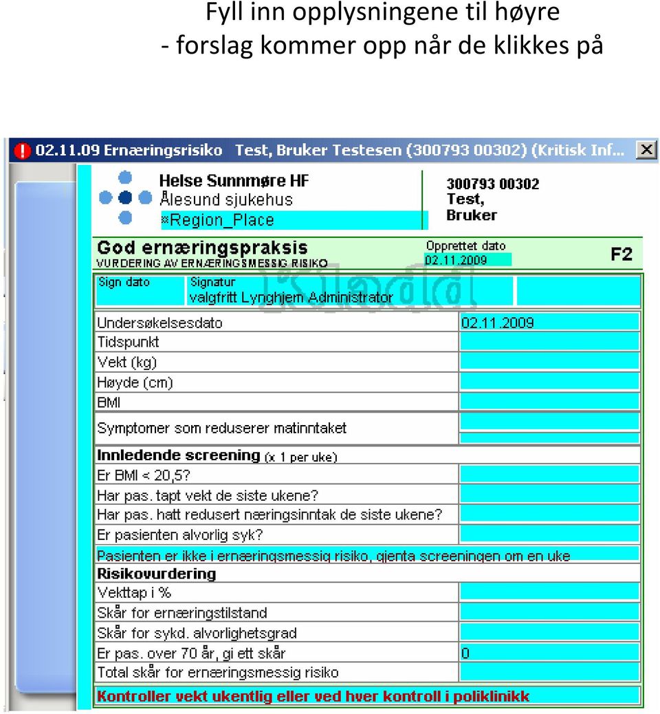 høyre forslag