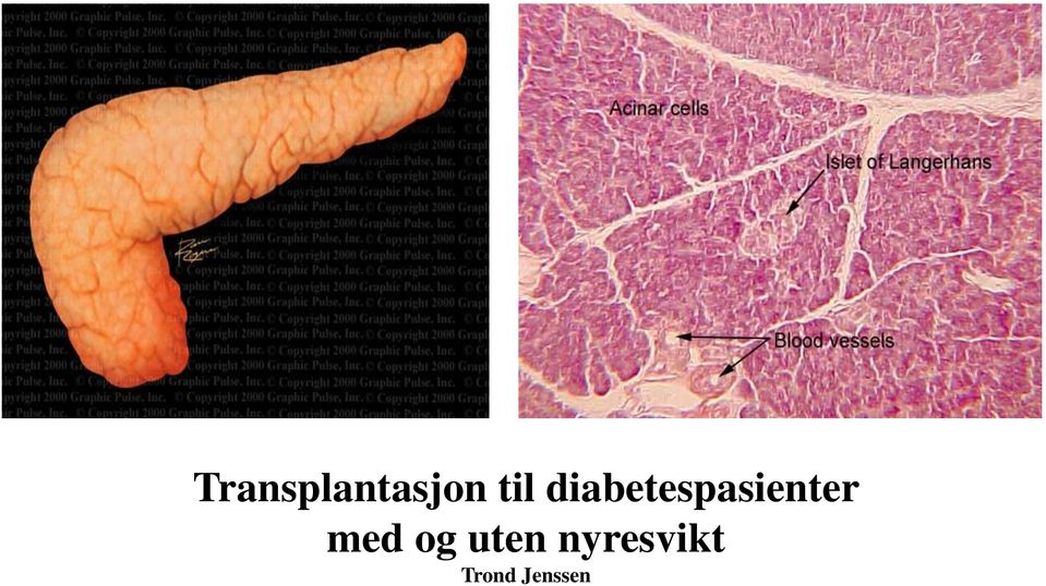 diabetespasienter