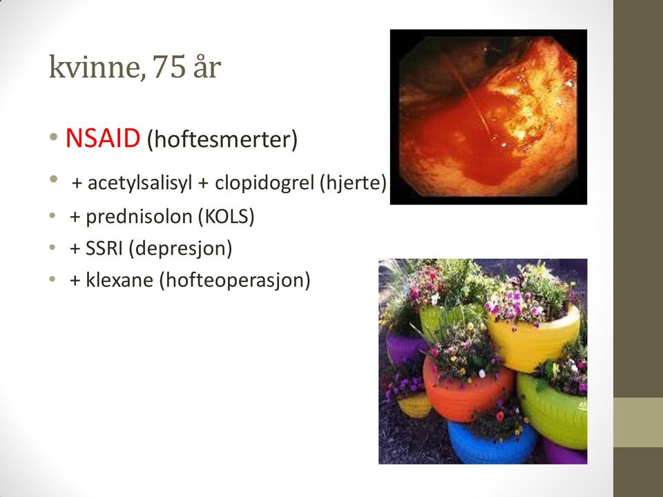 (hjerte) + prednisolon (KOLS) +