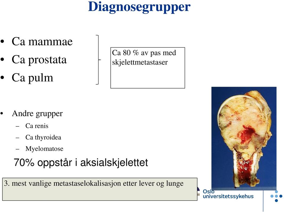 thyroidea Myelomatose 70% oppstår i aksialskjelettet 3.